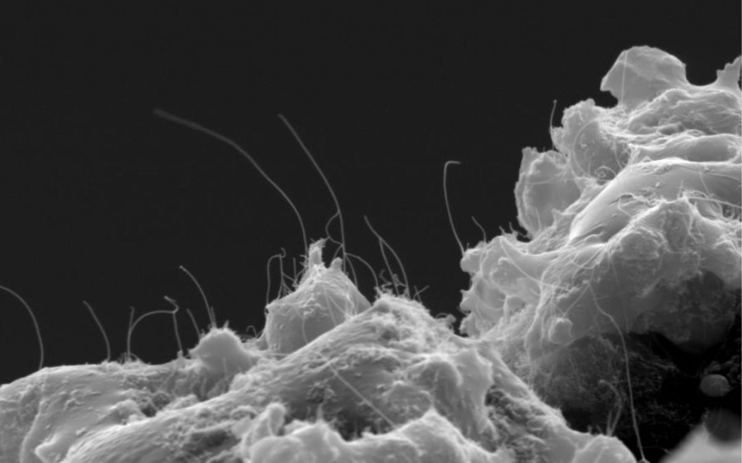 Carbon nanotubes on a Micro-X emitter